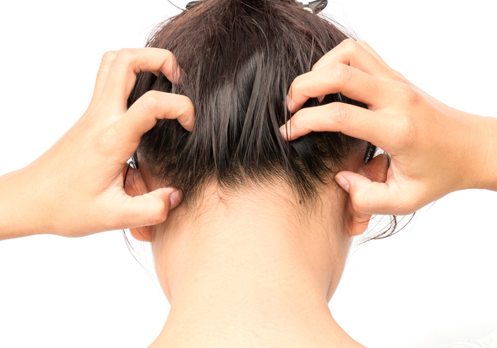 woman scratching head, scalp