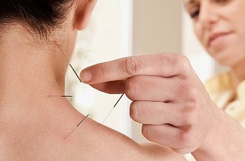 Acupuncturist sticks needle into woman's neck