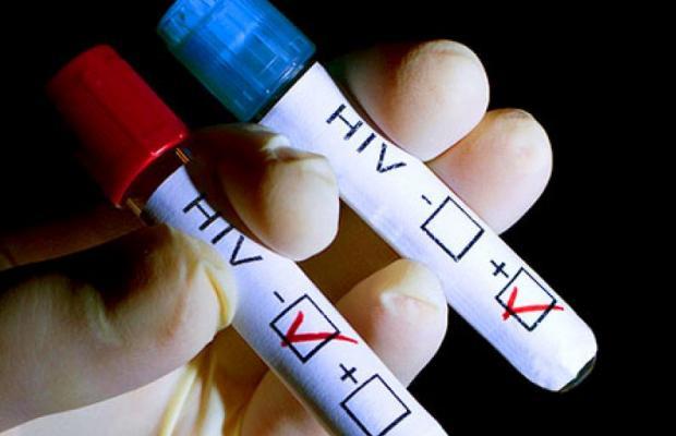 HIV, VIH, HIV Test, Spanish HIV