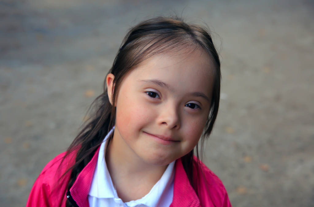 beautiful girl, girl with down syndrome, smiling girl