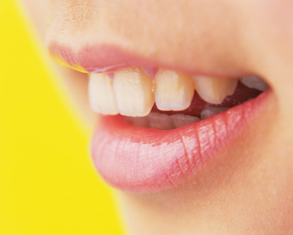 yellow teeth, closeup of teeth, teeth, smile with teeth