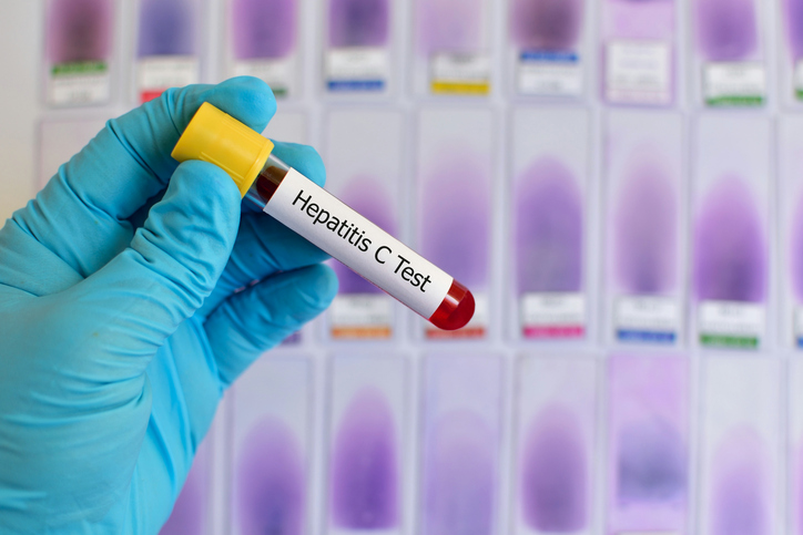 Blood sample for hepatitis C virus testing