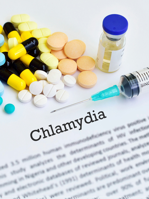chlamydia test