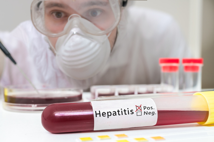 hepatitis c test