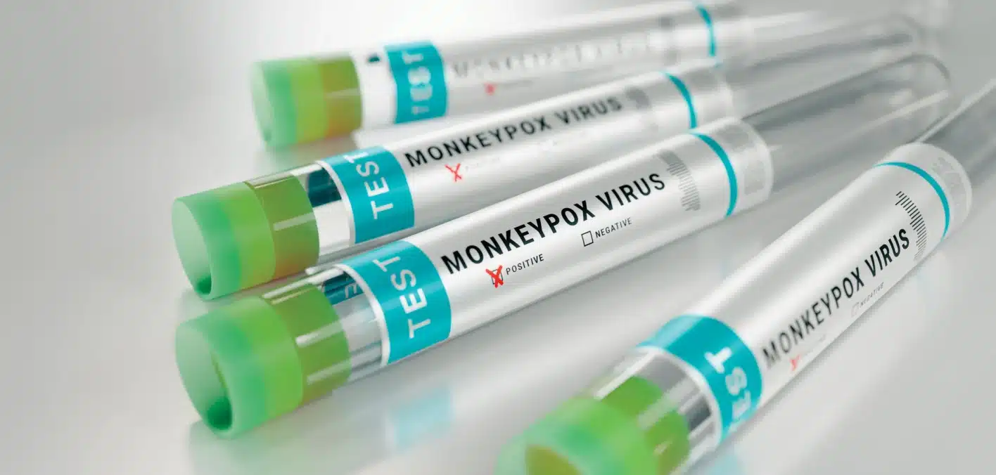 Persisten los Impactos Duraderos en la Salud y Sociales para Muchos Tras el Brote de Viruela del Mono de 2022.
