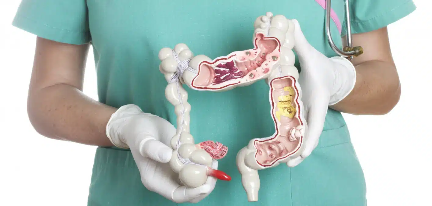 El cáncer colorrectal emerge como la principal amenaza para los adultos jóvenes a pesar de la disminución general en las muertes por cáncer en menores de 50 años.