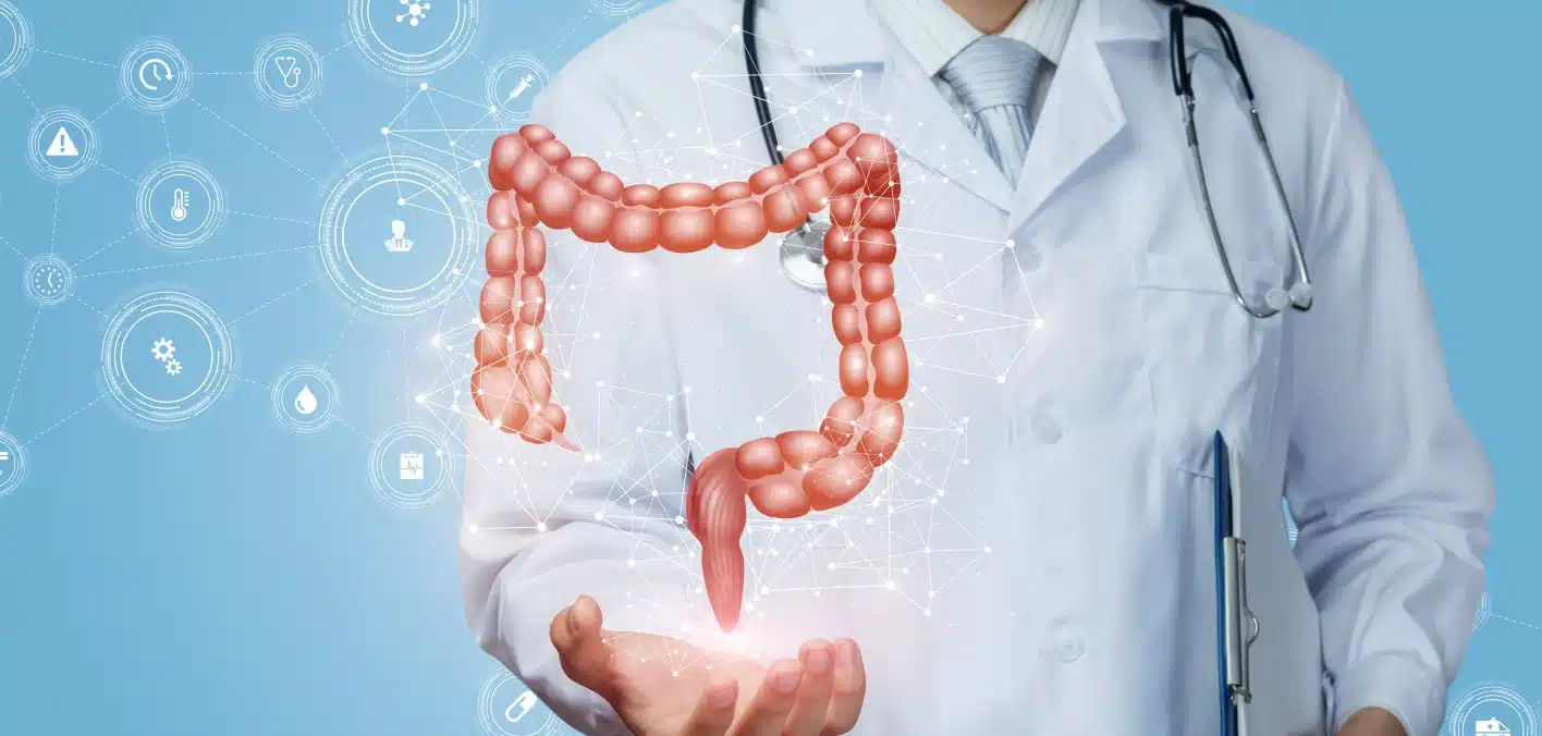 Cómo Reducir tu Riesgo de Cáncer Colorrectal: Consejos Clave de Expertos de la Universidad de Colorado