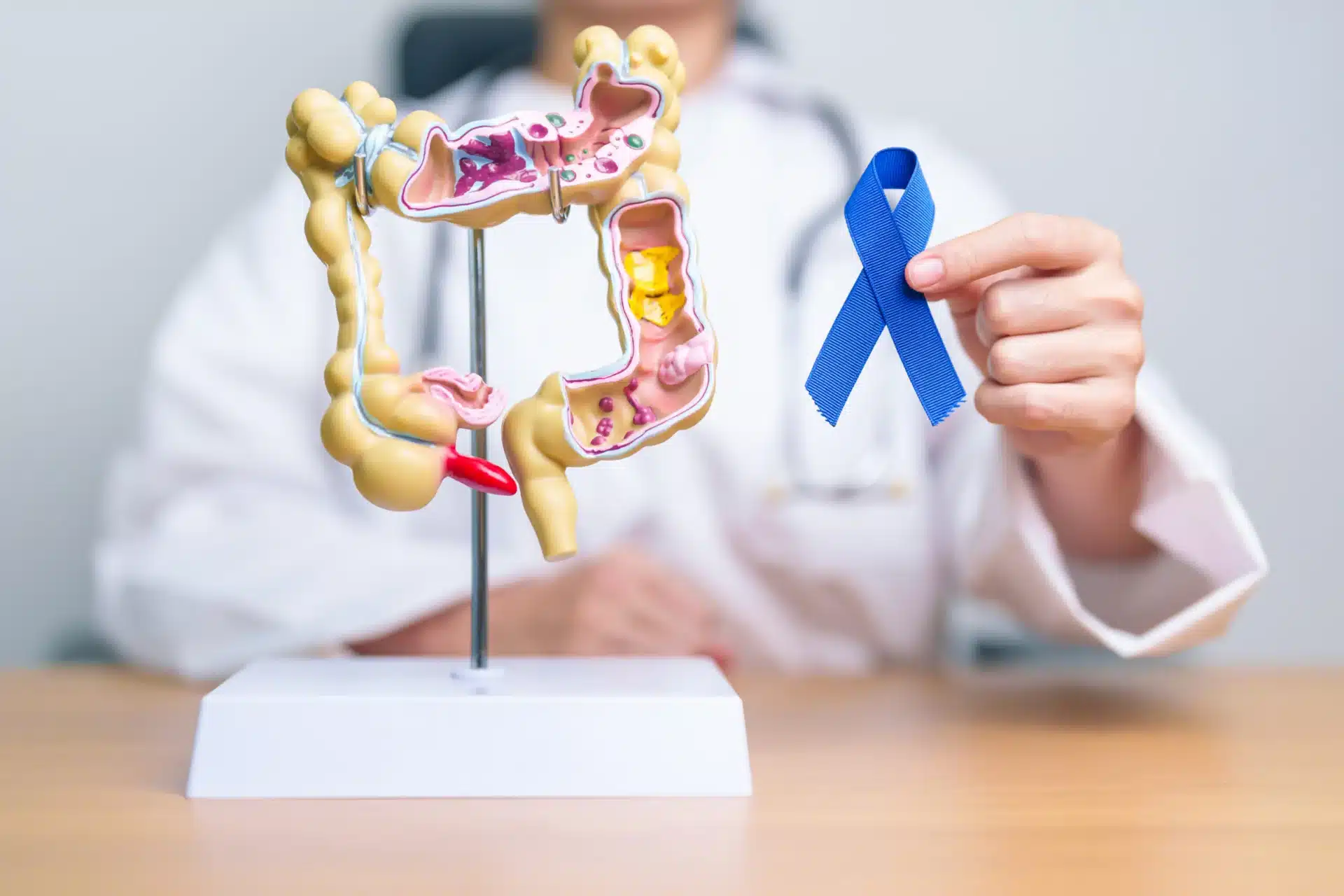 8 Keys to Prevent and Detect Colorectal Cancer Early This Awareness Month