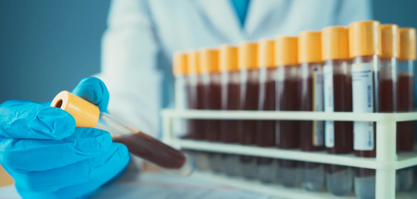 Las prometedoras ‘biopsias líquidas’ pueden no estar listas para su uso generalizado